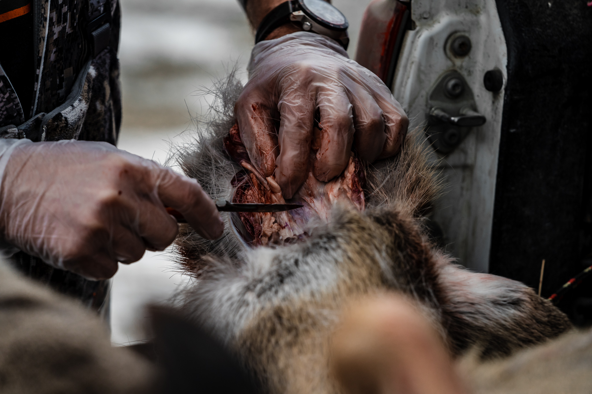 collecting the lymph node