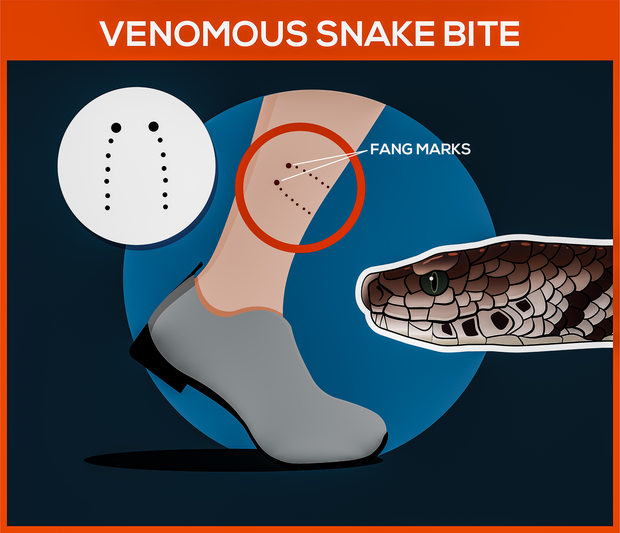 how to survive a snakebite