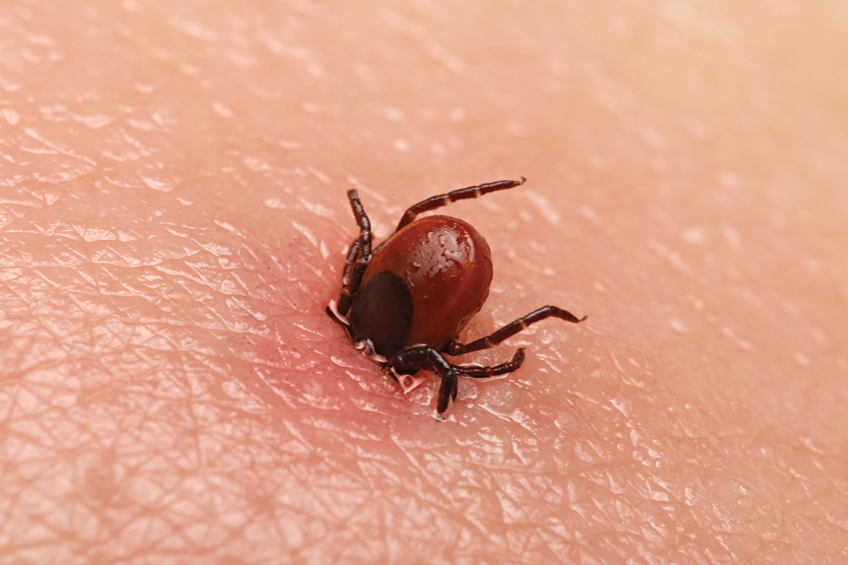 tick bite